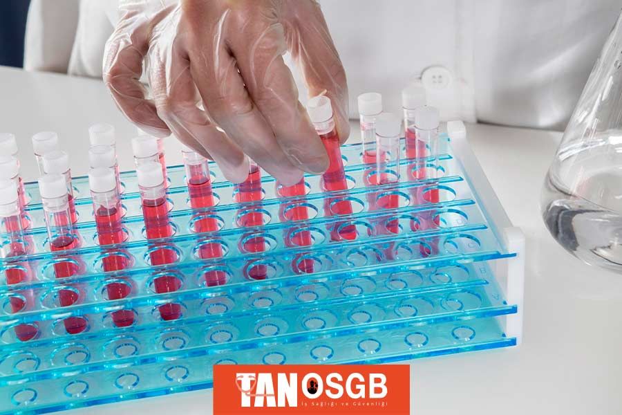 Kan Testi Çeşitleri Nelerdir? - Tan OSGB