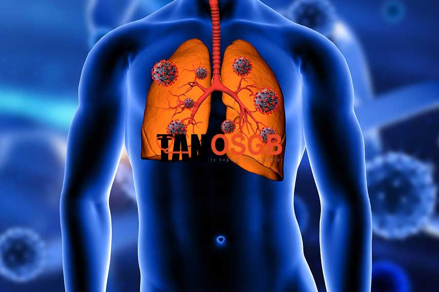 Sağlıklı Akciğer Grafisi Nasıl Olmalı? - Tan OSGB