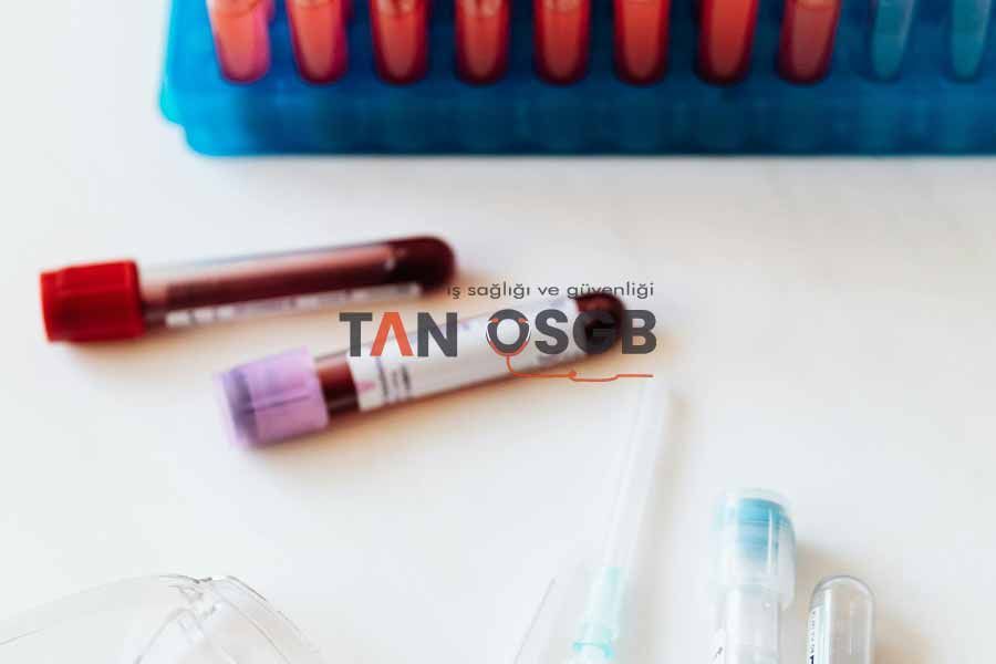 Kan ve İdrar Tahlilili İstanbul Bahçelievler - Tan OSGB