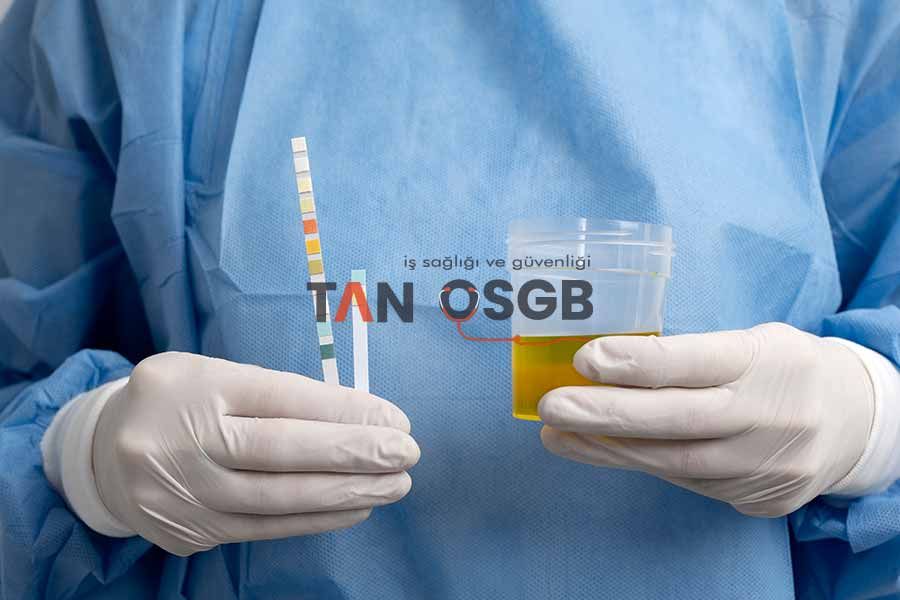 İdrar Tahlili Ne Sıklıkla Yapılmalıdır? - Tan OSGB