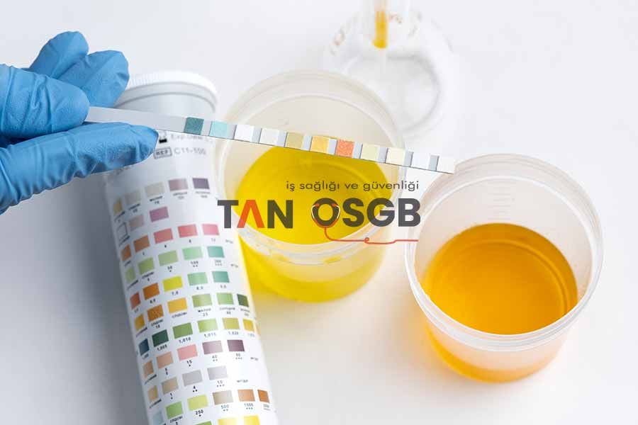 İdrar Tahlili Ne Zaman Çıkar? Tam İdrar Tahlili Nasıl Yapılır? - Tan OSGB