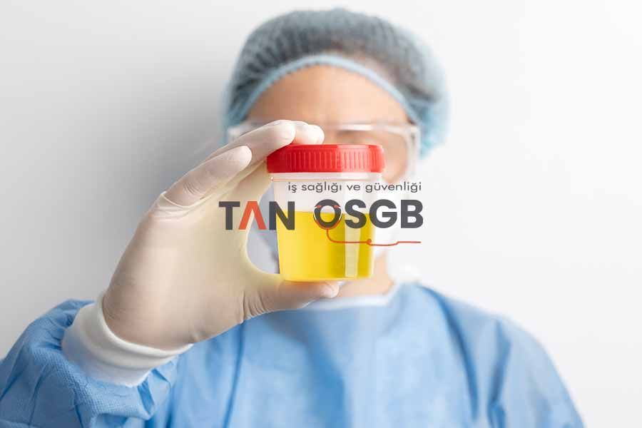 İdrar Tahlili Ne Zaman Gerekli Olmaktadır? - Tan OSGB