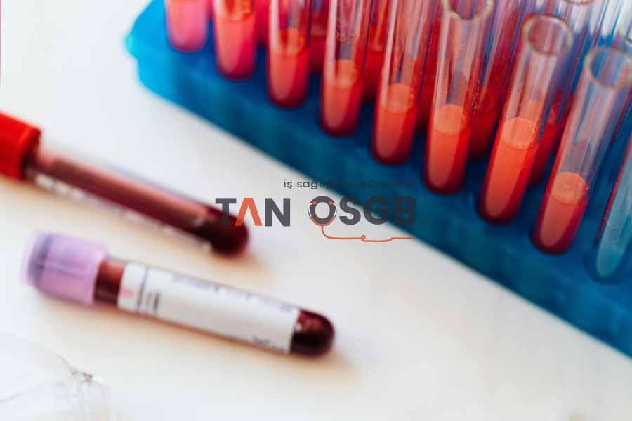 Kan ve İdrar Tahlili İstanbul Bahçelievler Şirinevler