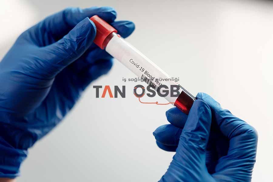 Kan ve İdrar Tahlili Nasıl Yapılır? - Tan OSGB