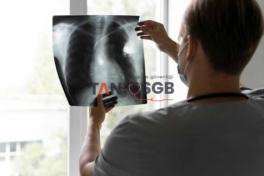 Akciğer Grafisi İstanbul - Tan OSGB