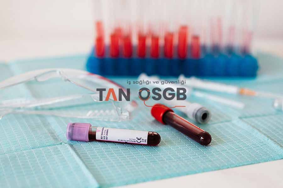 Kan ve İdrar Tahlili İşe Giriş İçin